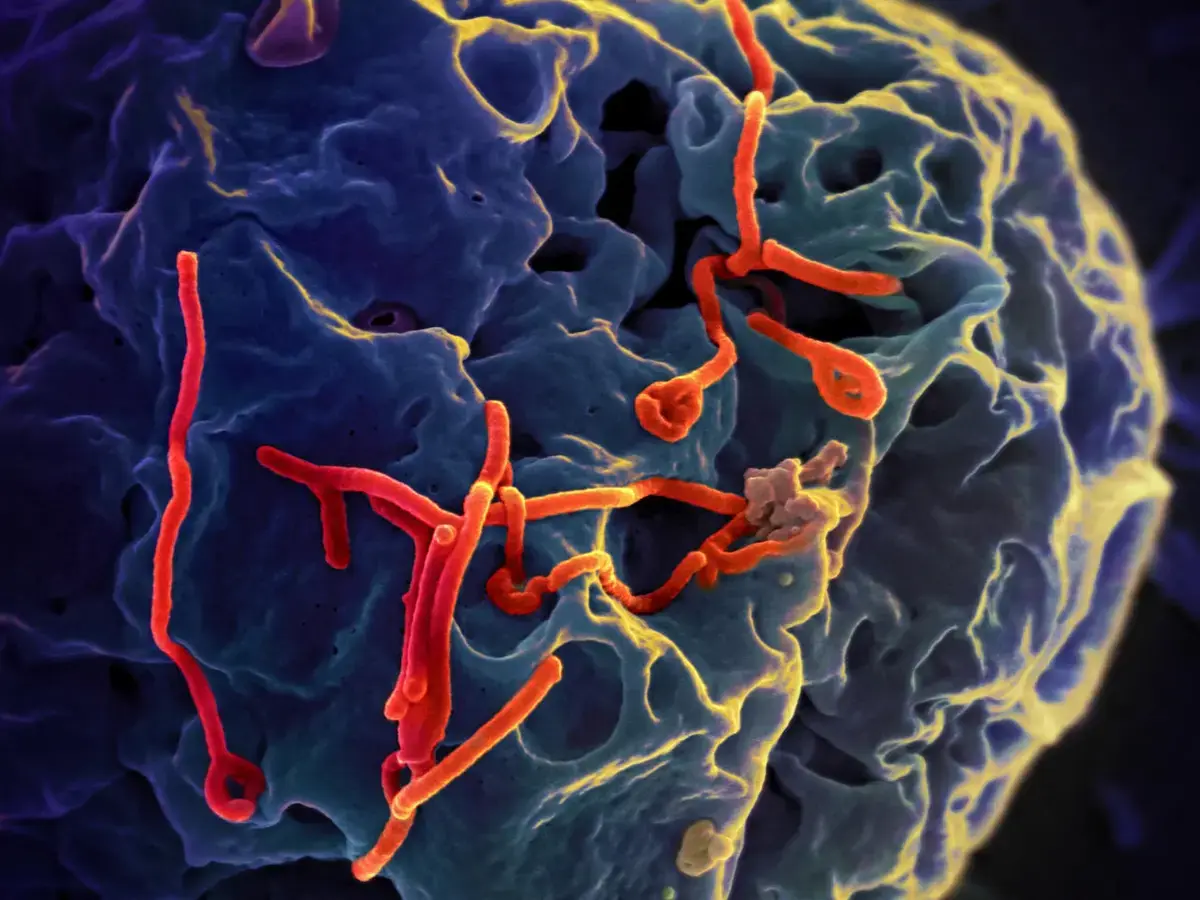 Ebola Outbreak Expands to South Kivu Amid Ongoing Conflict